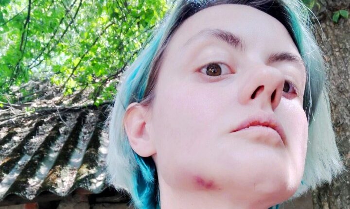 В Ужгороді п’яний працівник військкомату побив дружину військового